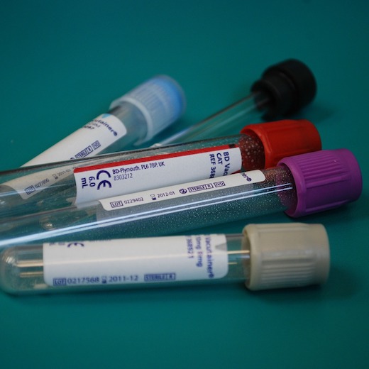 Anemia w ciąży